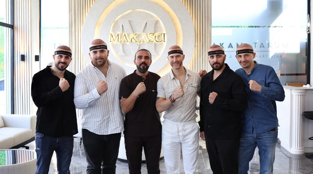 Saç Ekimi Nedir ve Nasıl Yapılır? Murat Makascı Klinik ile Hayalinizdeki Saçlara Kavuşun